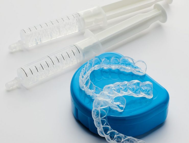 Sporting Smiles — Custom Dental Products at a Professional Level