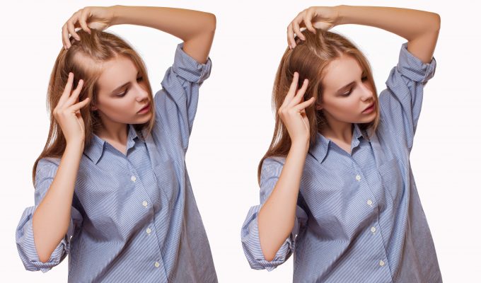 WHAT EFFECTS, CBD OIL CAN MAKE ON OUR HAIR LOSS OR GROWTH-min