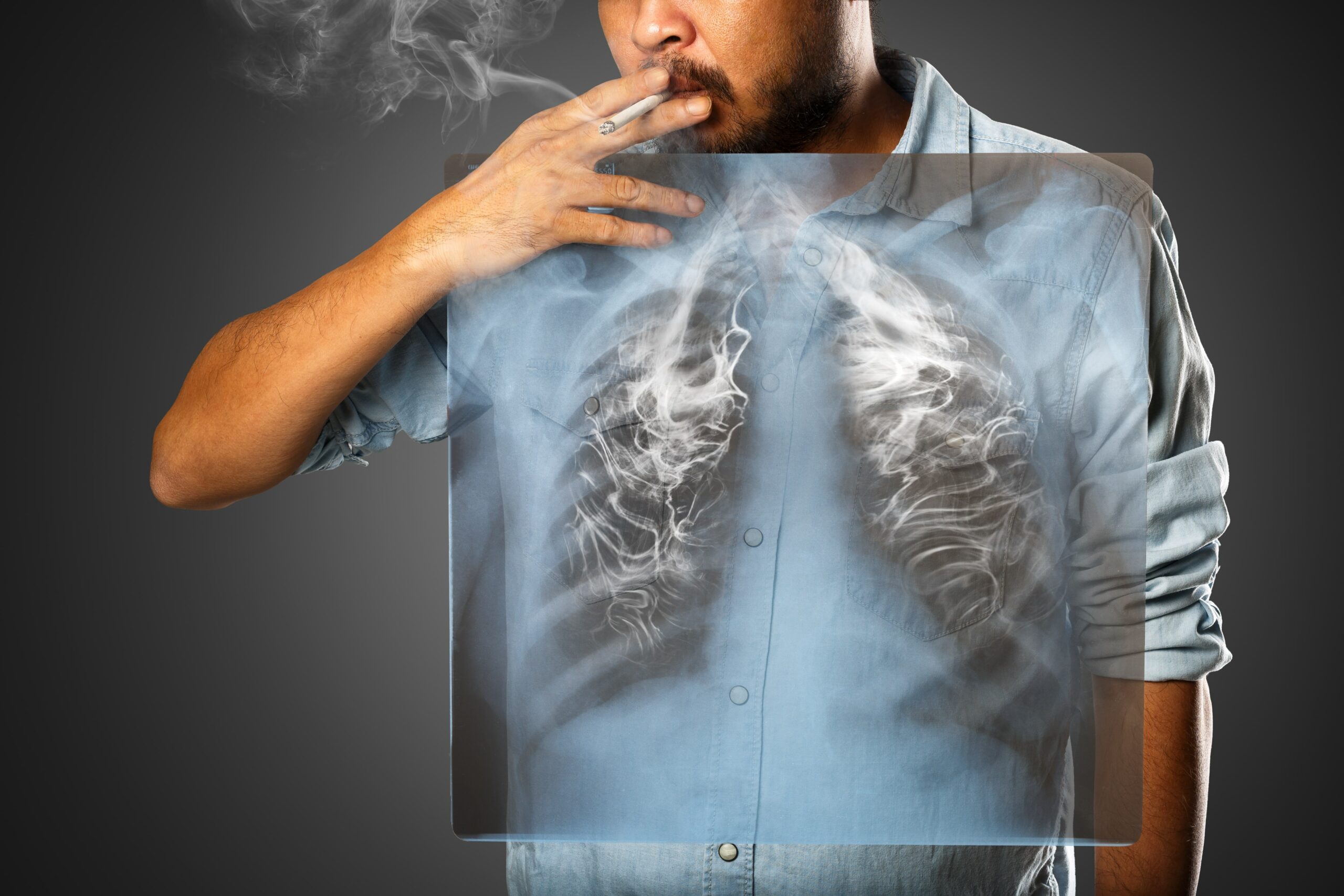 Early Signs of Lung Cancer-min
