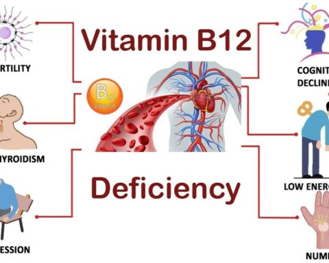 A LESSER-KNOWN SIGN OF B12 DEFICIENCY