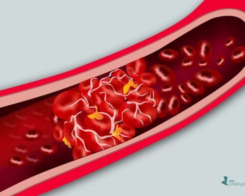 RISK OF BLOOD CLOTS.