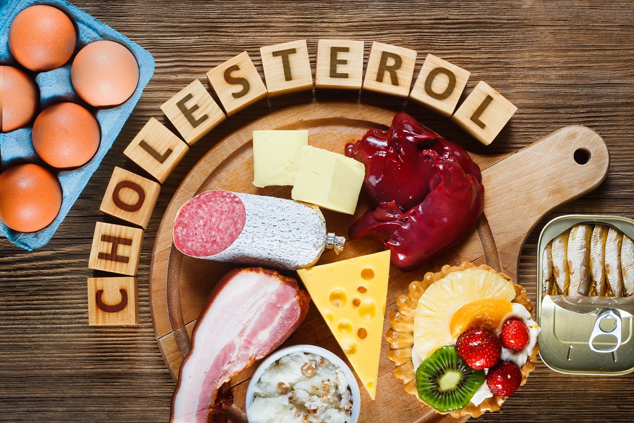 SIGNS YOU HAVE HIGH CHOLESTEROL
