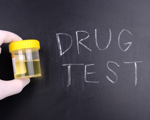 DOES CBD SHOW UP ON A DRUG TEST?