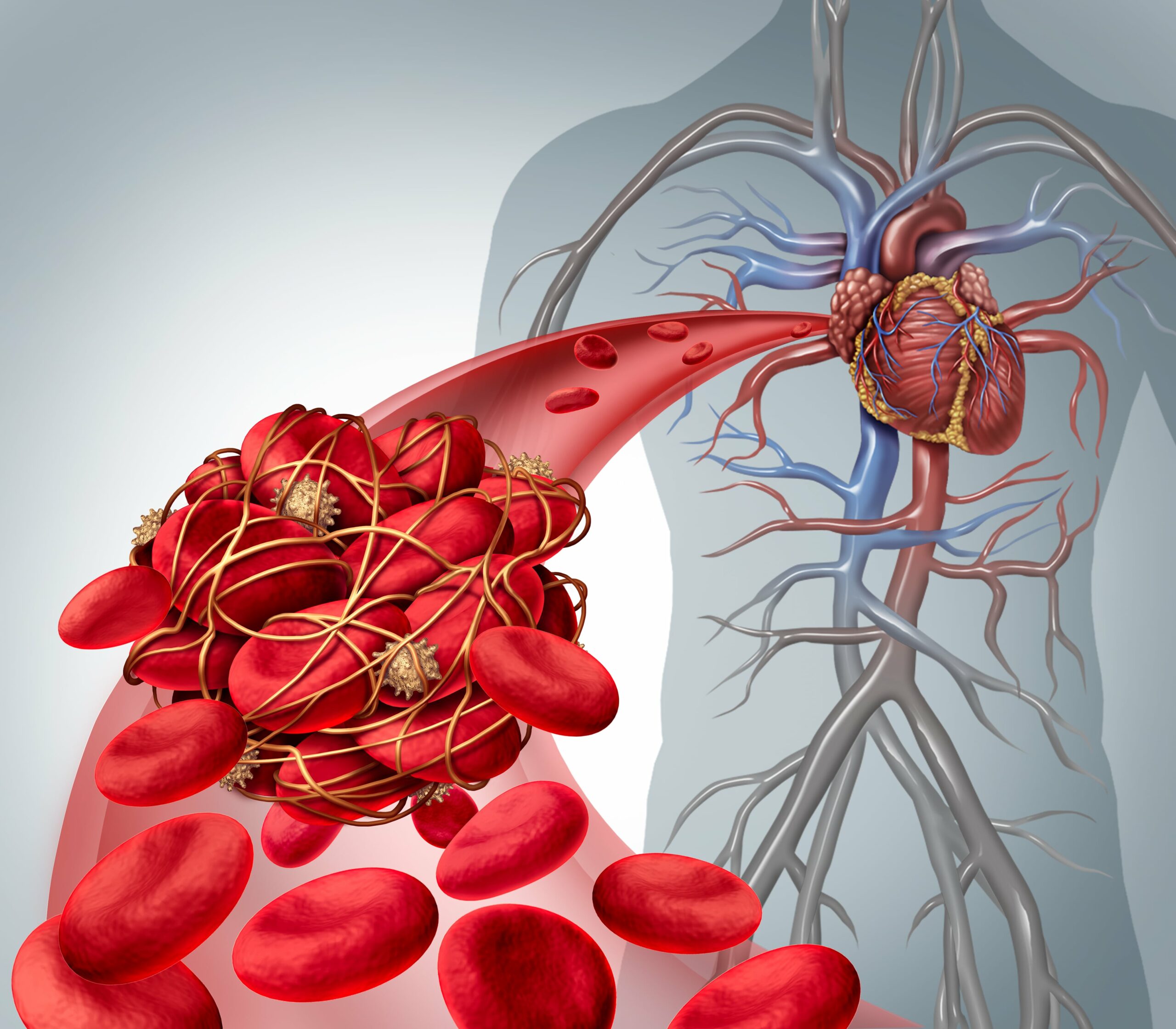 Food or Drinks That Raise the Risk of Blood Clots