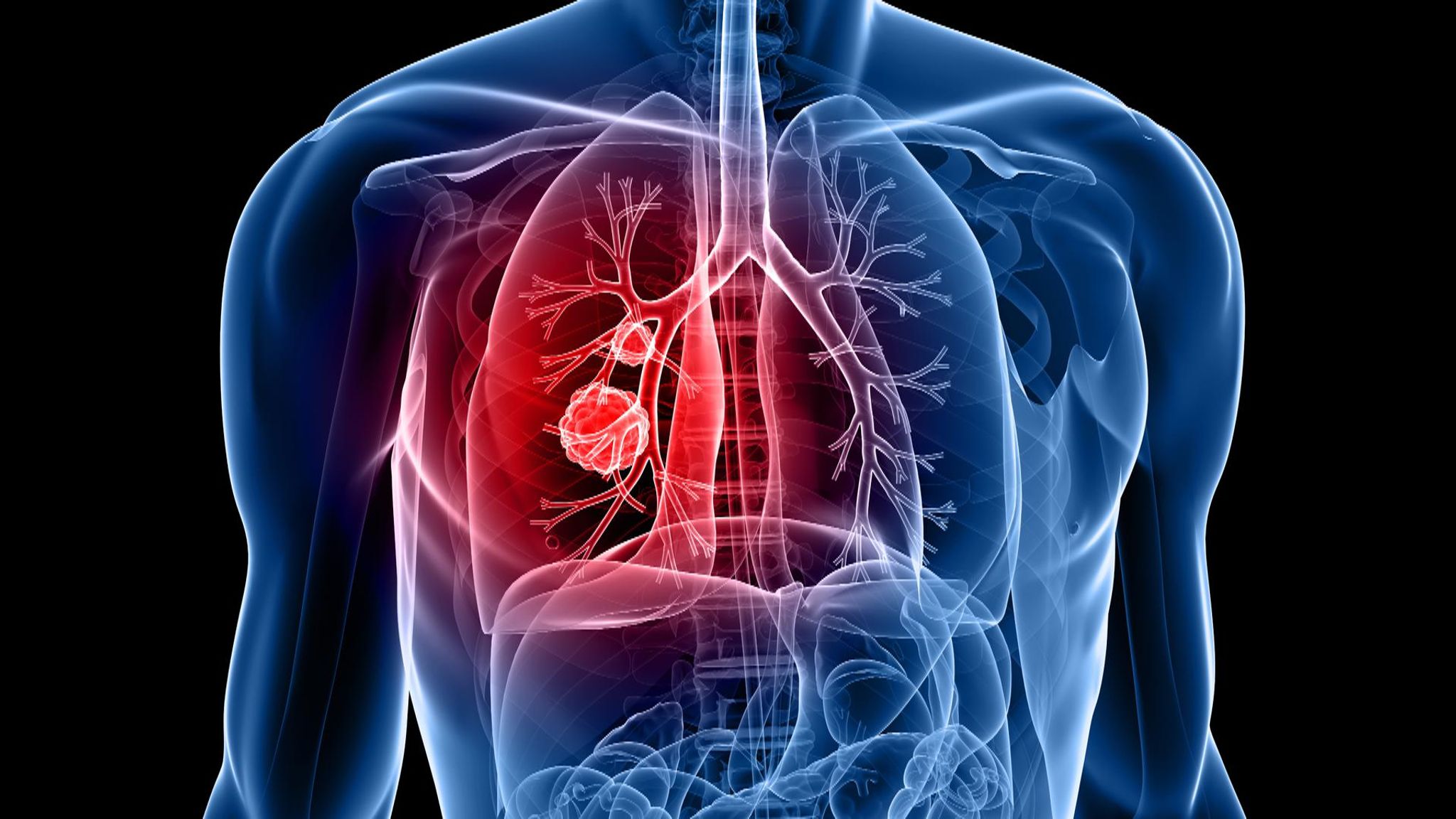 NON-SMOKING RELATED RISK FACTORS FOR LUNG CANCER