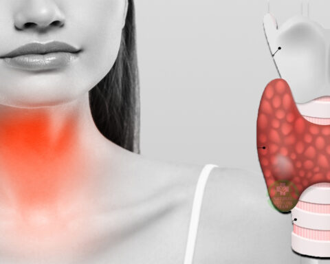Under-Active Thyroid