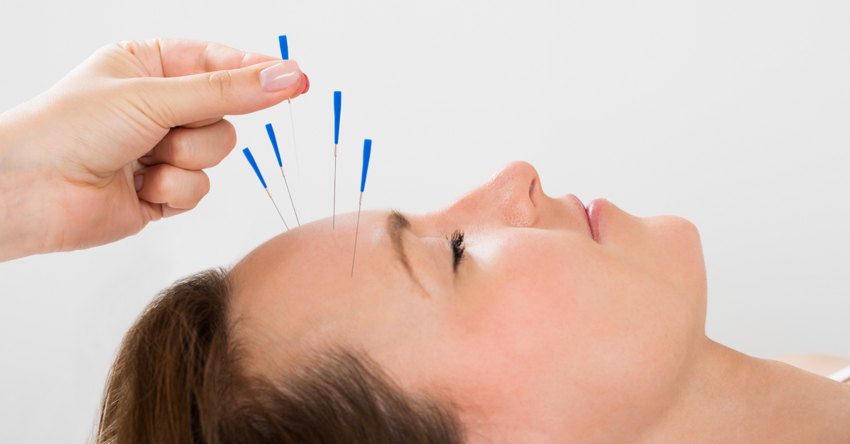 Acupuncture Dream Meaning Interpret Now