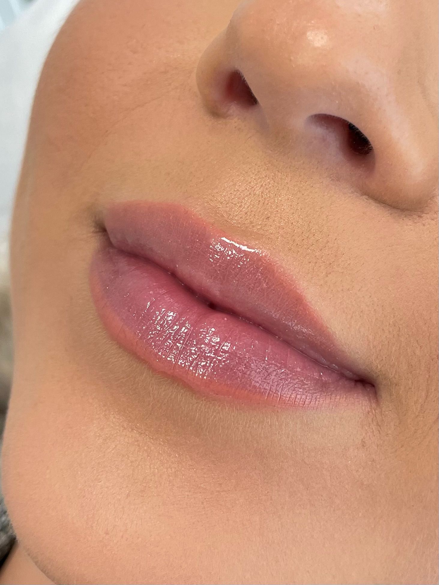 Lip Fillers for Men: The Growing Trend in the UK