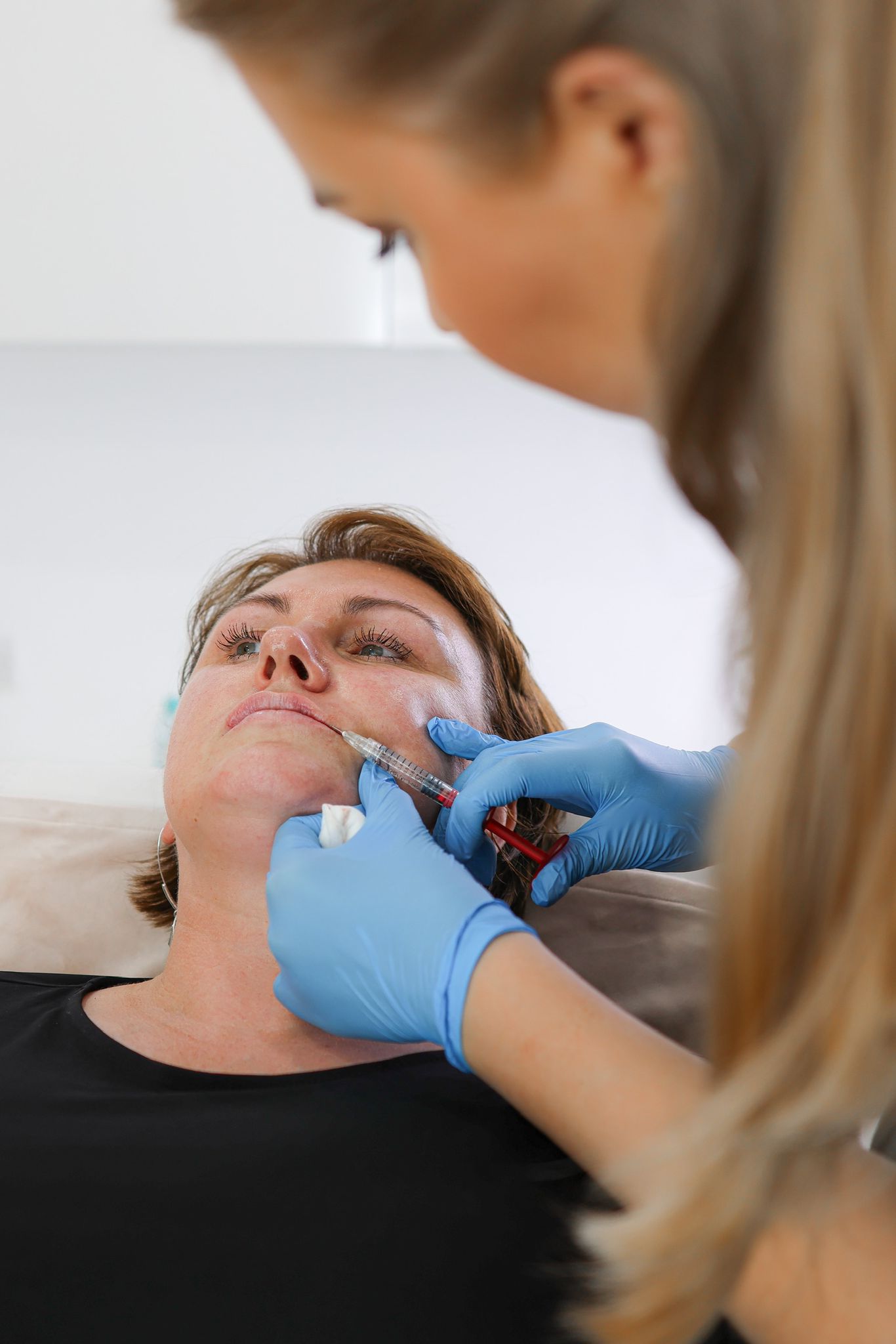 Lip Filler London – Natural Lip Enhancement & Lip Augmentation